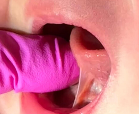 Mother's Journey tongue tie care South London