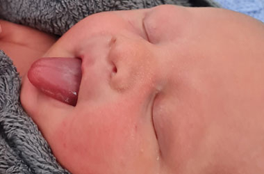 Mother's Journey tongue tie South London